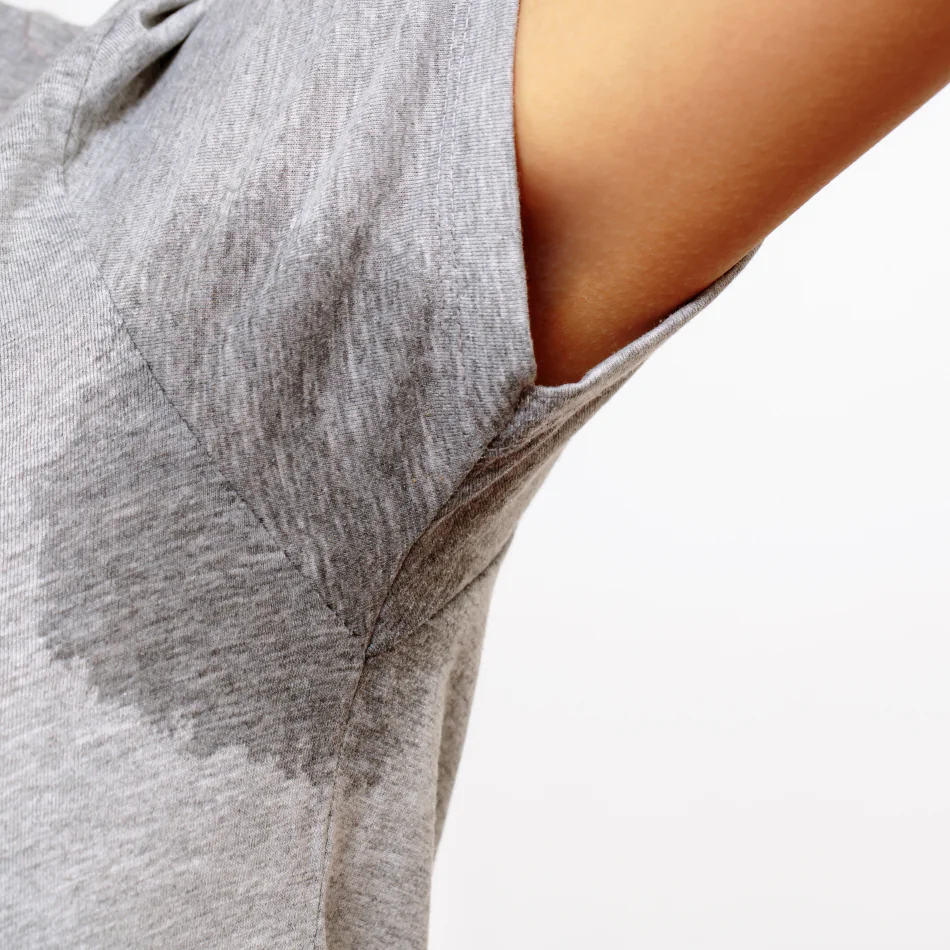 Hiperhidrosis