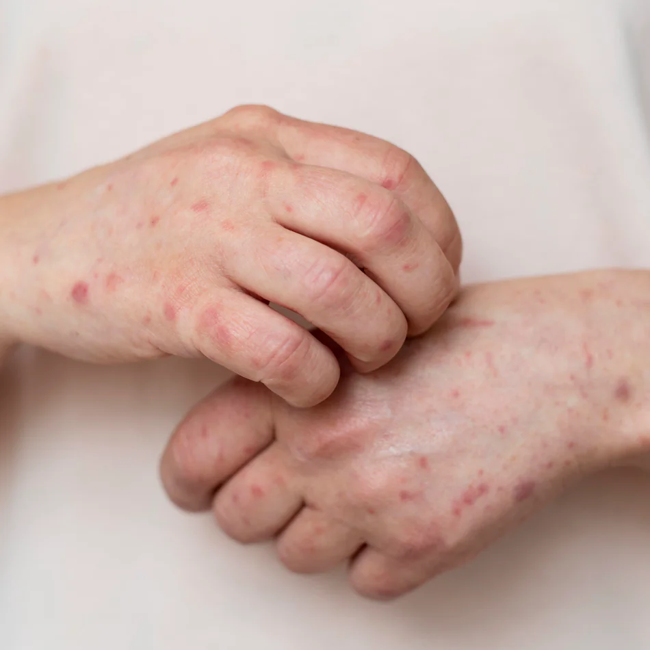 indice de dermatologia