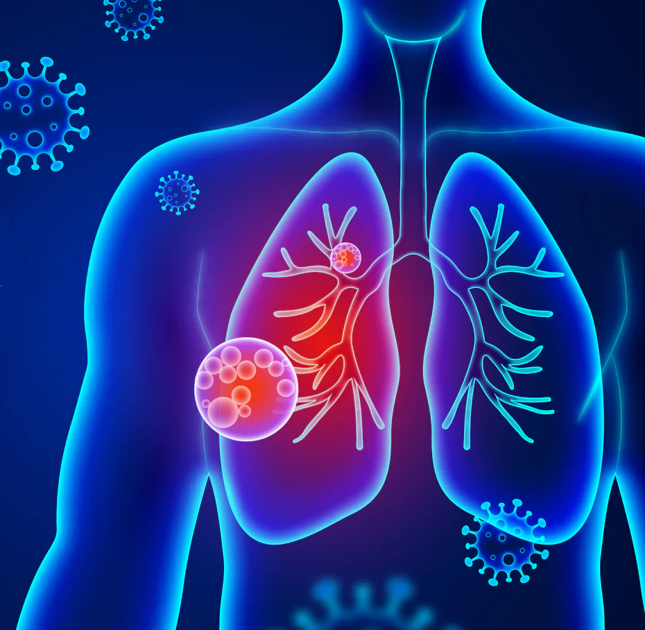 Pulmones